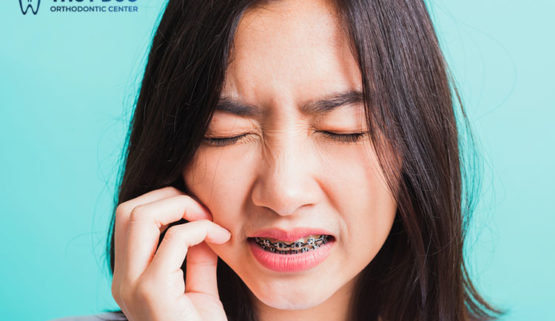 Đau nhức răng khi niềng răng phải làm sao?