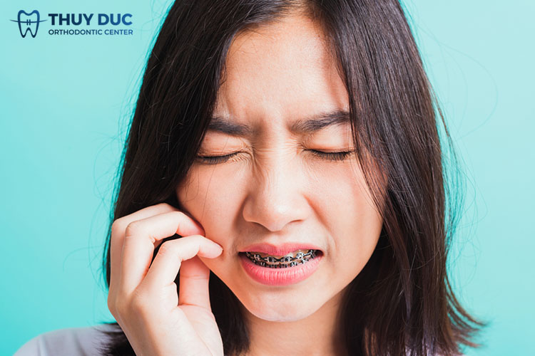 Nguyên nhân gây đau nhức răng khi niềng răng? 1 Nguyên nhân gây đau nhức răng khi niềng răng? 1
