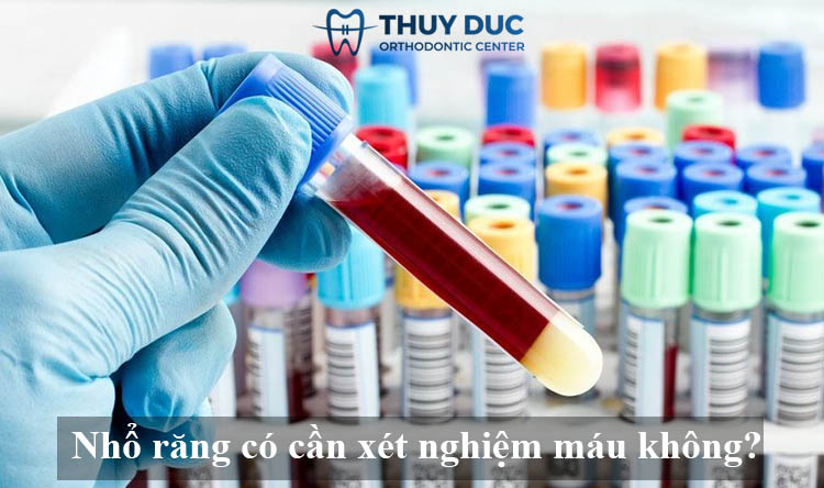 1. Nhổ răng có cần xét nghiệm máu không? 1 1. Nhổ răng có cần xét nghiệm máu không? 1