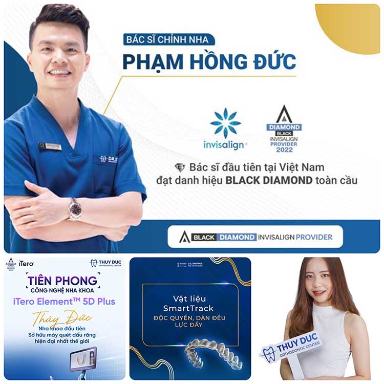 5. Mách bạn địa chỉ niềng răng uy tín tại Hà Nội 1 5. Mách bạn địa chỉ niềng răng uy tín tại Hà Nội 1