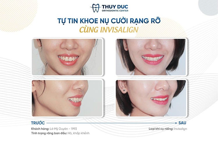 5. Nha khoa Thúy Đức- Địa chỉ niềng răng uy tín 2