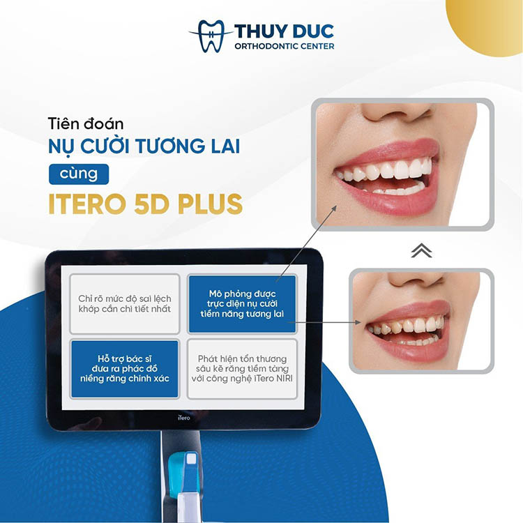 Mách bạn địa chỉ nha khoa niềng răng ít đau, hạn chế nhổ răng 2 Mách bạn địa chỉ nha khoa niềng răng ít đau, hạn chế nhổ răng 2