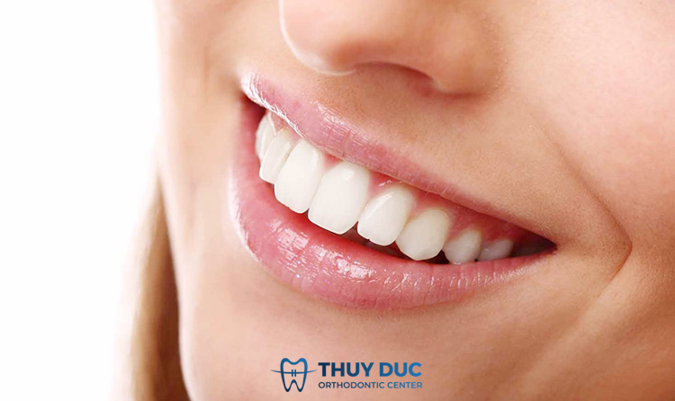 Bọc răng sứ 1 Bọc răng sứ 1