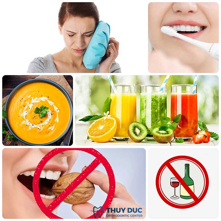 Trường hợp bị sốt nhẹ 1 Trường hợp bị sốt nhẹ 1