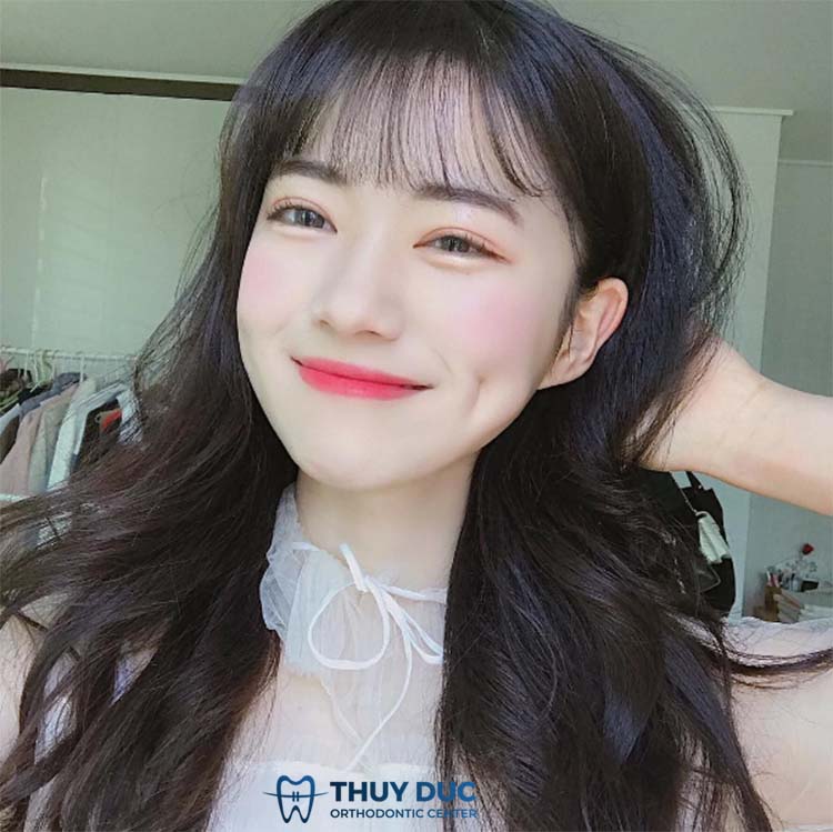 Cười mỉm 1 Cười mỉm 1