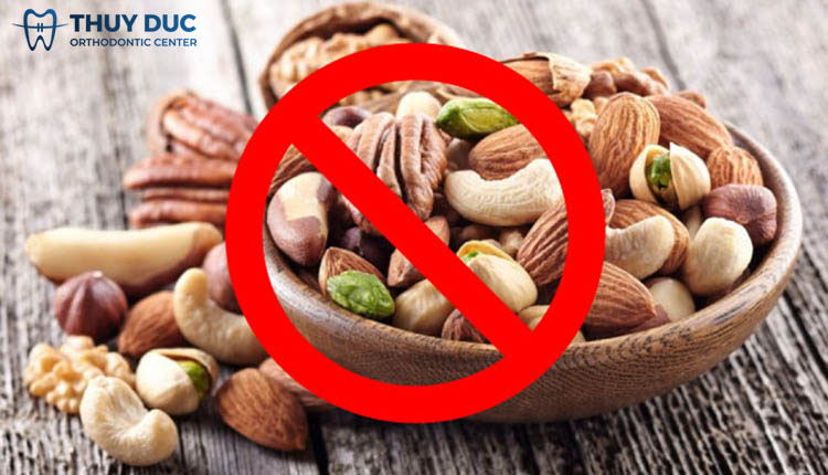 6. Hướng dẫn cách phòng tránh bung tuột dây cung 3