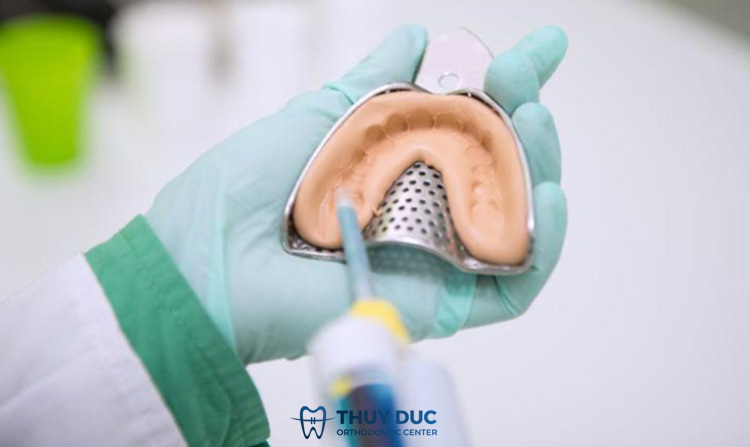 Lấy dấu răng khi niềng răng có tác dụng gì? 1 Lấy dấu răng khi niềng răng có tác dụng gì? 1