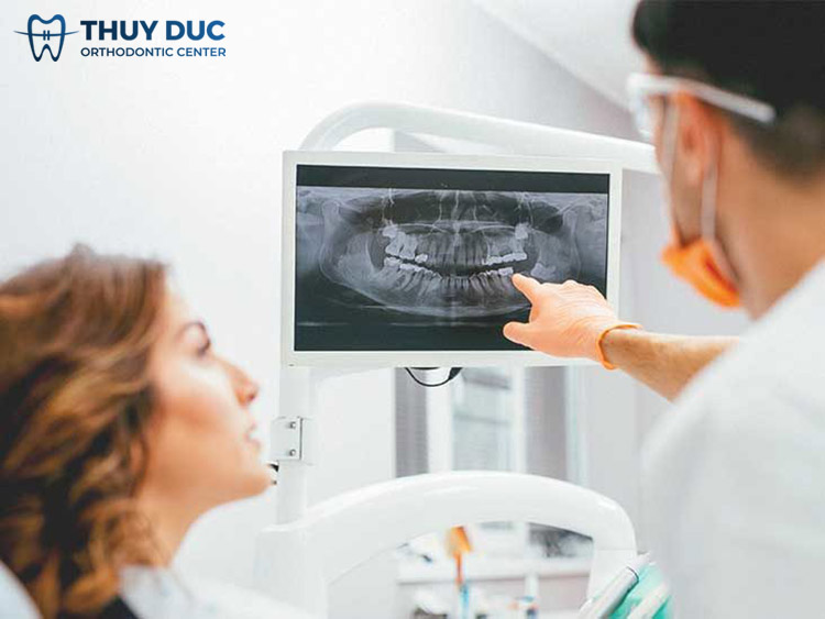 2. Khi nào thì cần phải chụp X-quang răng? 1