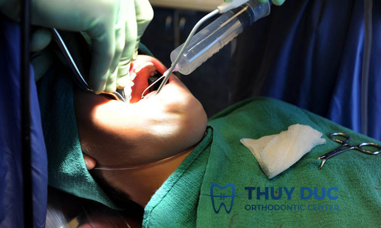 Điều trị phẫu thuật với bệnh viêm nha chu 1