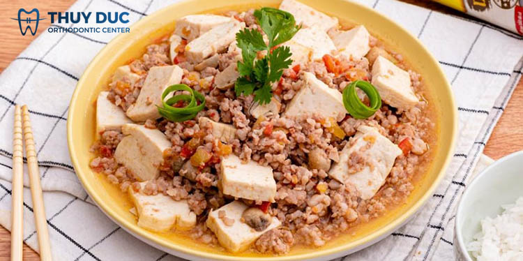 Chế độ ăn uống khi niềng răng 1 Chế độ ăn uống khi niềng răng 1