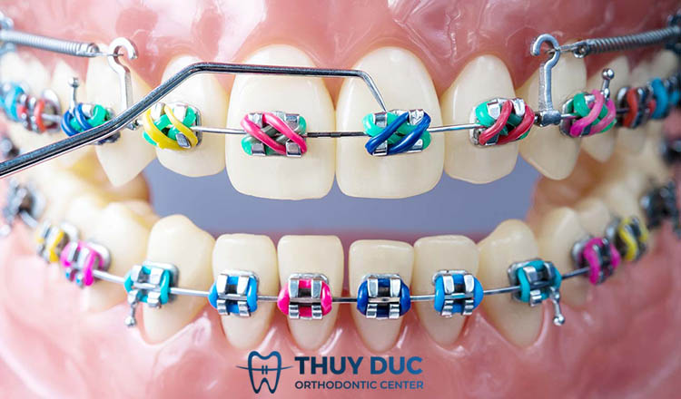 Kiểu dáng đa dạng 1 Kiểu dáng đa dạng 1