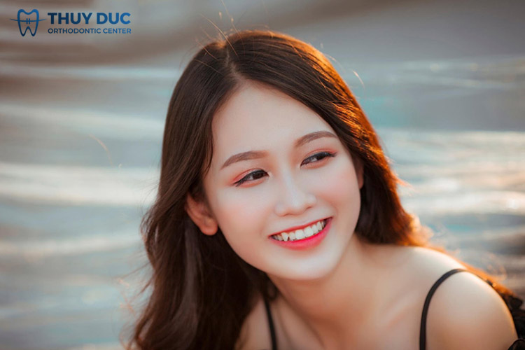 1. Thế nào là răng khểnh? 1